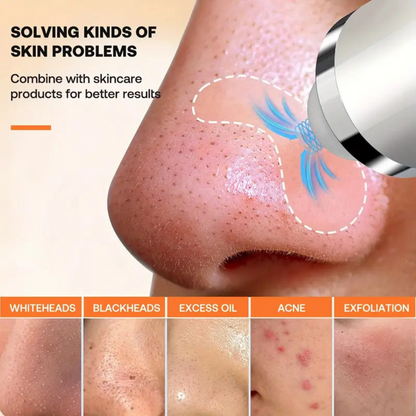 HD Visualization Electric Cleaning Blackhead Removal Machine