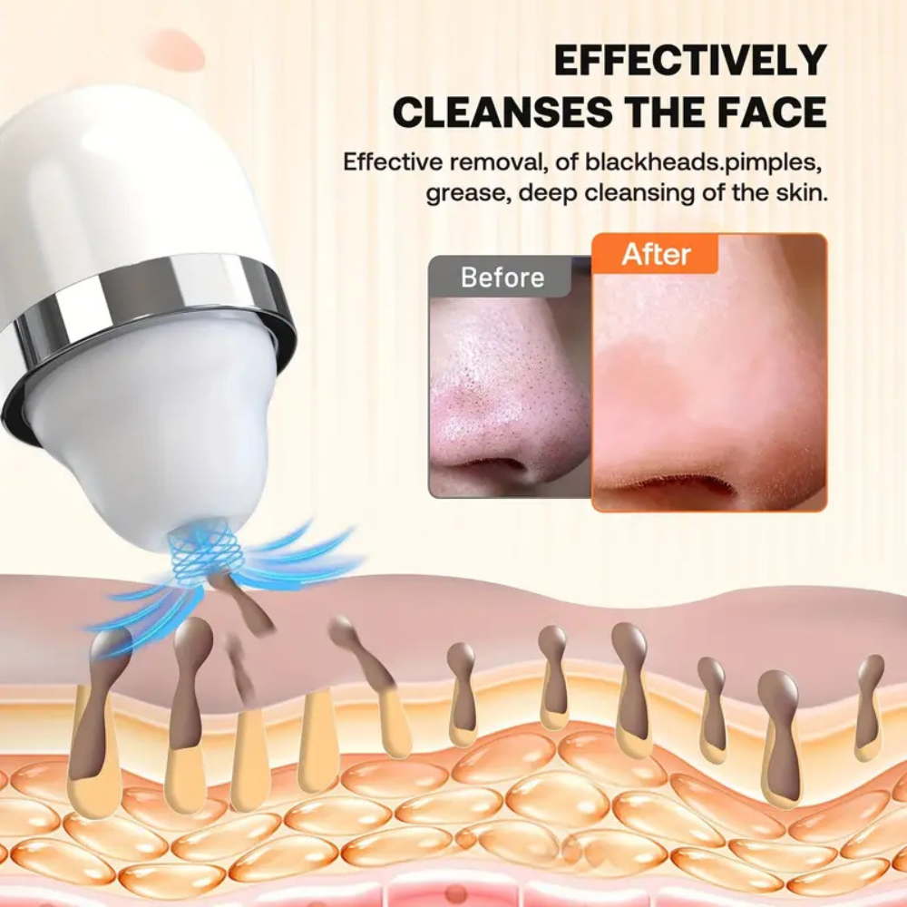 HD Visualization Electric Cleaning Blackhead Removal Machine